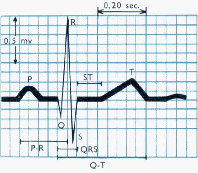 tracciato elettro cardio grafico ecg