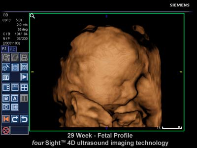 ultrasuoni feto faccia
