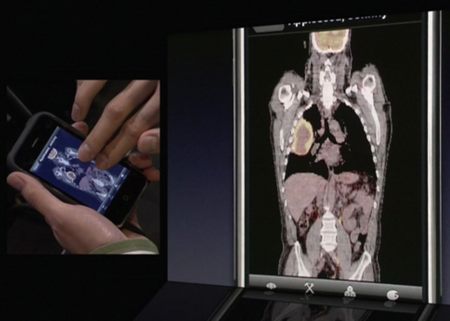 iphone software anatomia