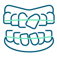 Allineatori dentali
